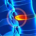 Treat Bulging Discs with Non-Surgical Spinal Decompression